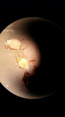 Rhynchospora elliottii