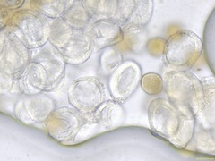 Gymnosporangium clavariiforme