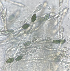 Cercophora silvatica