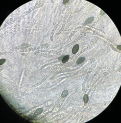 Cercophora silvatica