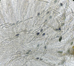 Cercophora silvatica