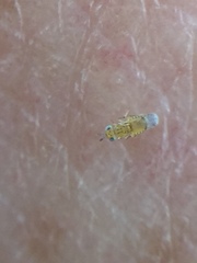 Aphytis