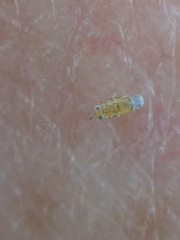 Aphytis