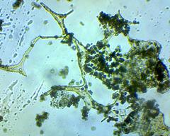 Cribraria rufa