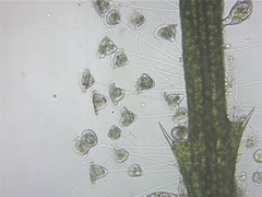 Vorticella campanula