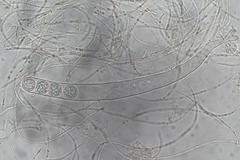 Pulvinula tetraspora