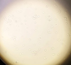 Saccharomyces cerevisiae