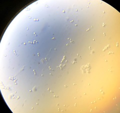 Saccharomyces cerevisiae