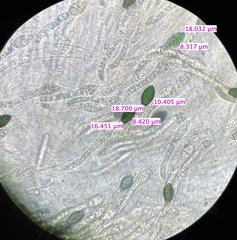 Cercophora silvatica