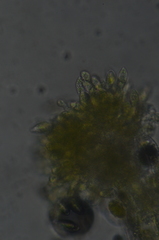 Cephaloziella spinigera
