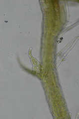 Cephaloziella spinigera