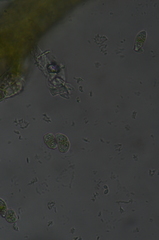 Cephaloziella spinigera