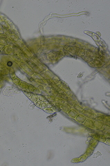 Cephaloziella spinigera
