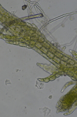 Cephaloziella spinigera