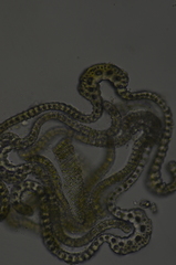 Racomitrium ericoides