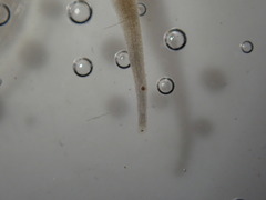 Helobdella stagnalis