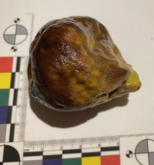 Asteropus