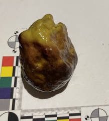 Asteropus