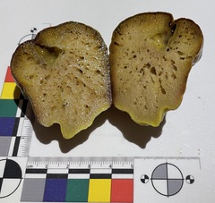 Asteropus