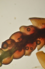Lophoziopsis excisa