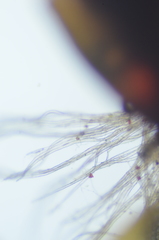 Lophoziopsis excisa