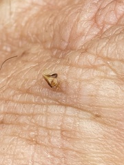 Neophyllura arbuti