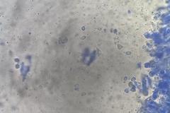 Leucopaxillus cerealis