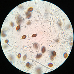 Melanogaster ambiguus