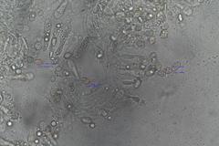 Entoloma albidocoeruleum