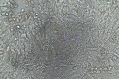 Entoloma albidocoeruleum