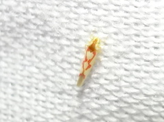 Zygina flammigera
