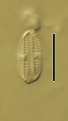 Amphora pediculus