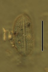 Cocconeis placentula