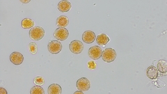 Puccinia graminis