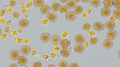 Puccinia graminis