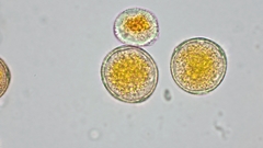 Puccinia graminis