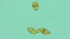 Puccinia liliacearum
