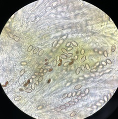 Ascobolus lineolatus