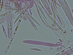 Lachnellula ellisiana