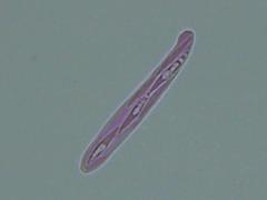 Lachnellula ellisiana