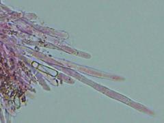 Lachnellula ellisiana