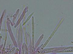 Lachnellula ellisiana