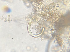 Ophiocytium