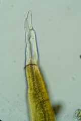Racomitrium sudeticum