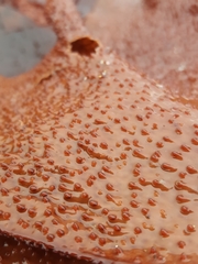 Chondracanthus