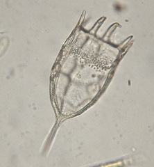 Keratella cochlearis