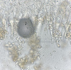 Macrocystidia