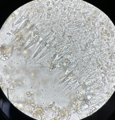 Macrocystidia