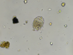 Euglypha strigosa