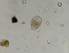 Euglypha strigosa